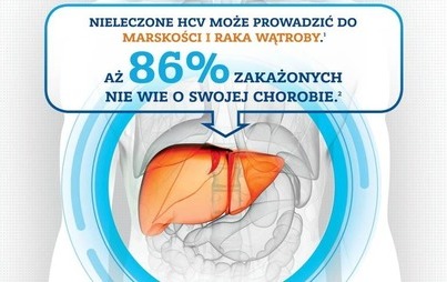 Zdjęcie do Bezpłatne badanie w kierunku HCV